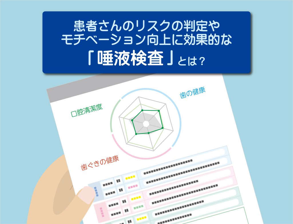 「唾液検査」によりう蝕・歯周病リスクを見える化!患者さんのセルフケアへのモチベーション向上へ