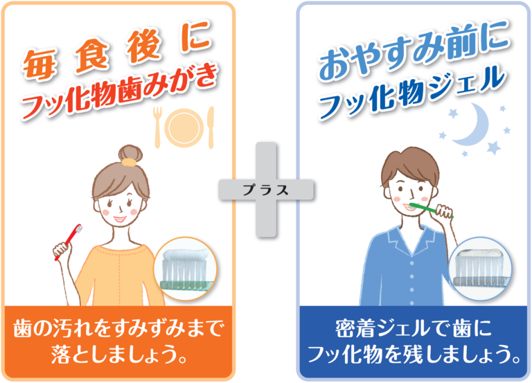 毎食後にフッ化物歯みがき+お休み前にフッ化物ジェル