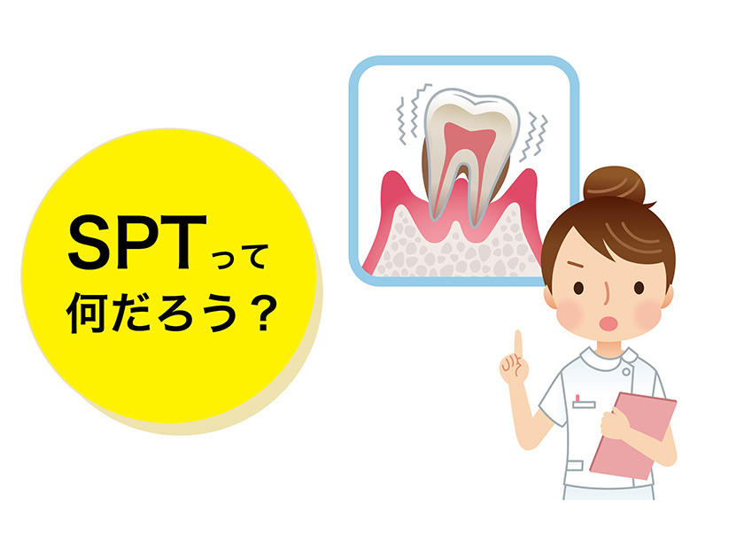 今後の歯周病治療のカギは「SPT」。SPT（サポーティブペリオドンタルセラピー）って何だろう？