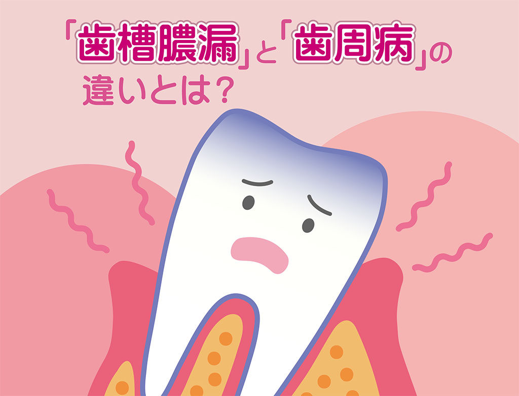 「歯槽膿漏」と「歯周病」の違いとは？