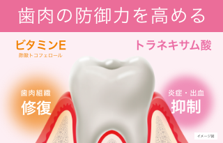 ホストケア（歯肉ケア）